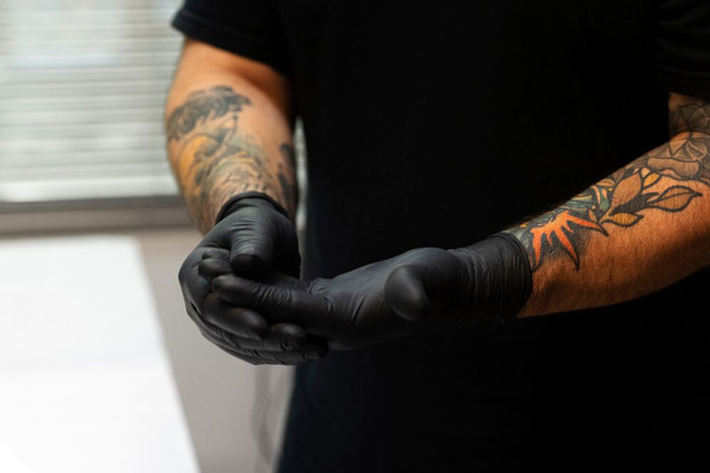 Cirugía y dermoabrasión eliminar tatuaje
